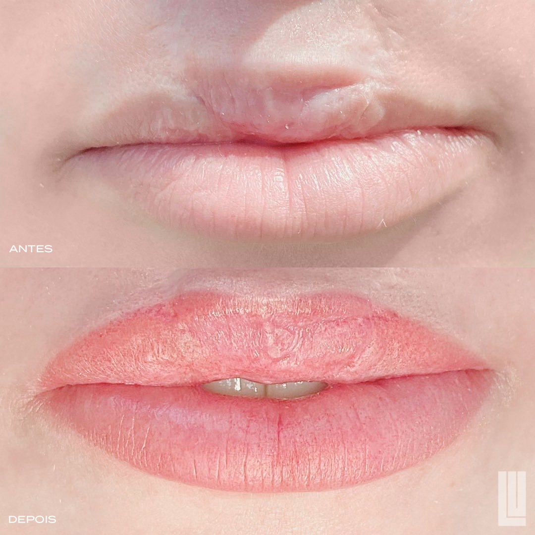 Reconstrução labial com micropigmentação paramédica - Lu Make Up