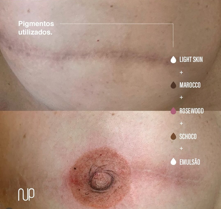 Reconstrução de aréola - Lu Make Up